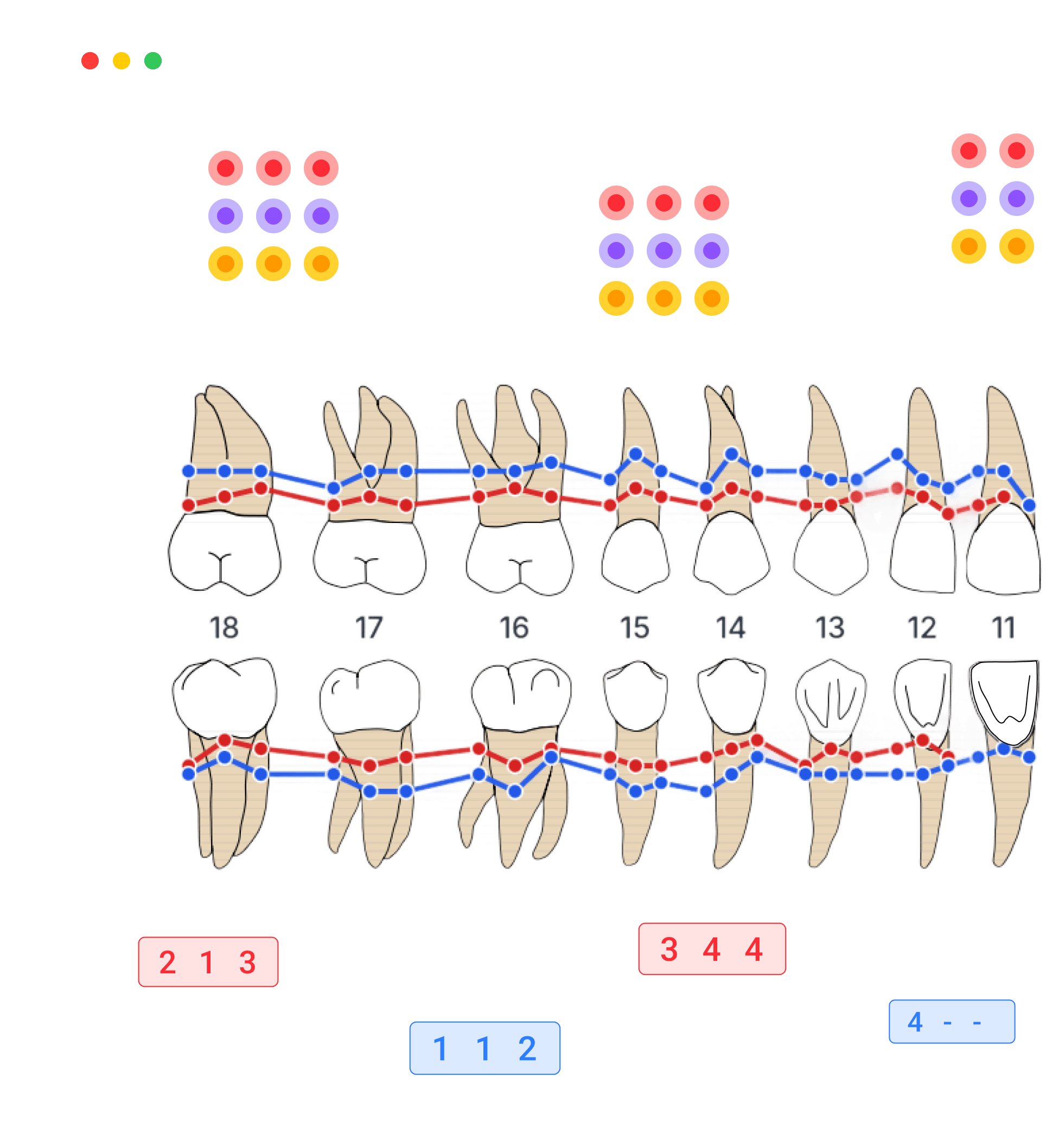 Fogászati szakember online parodontális ábrázoló eszközt használ