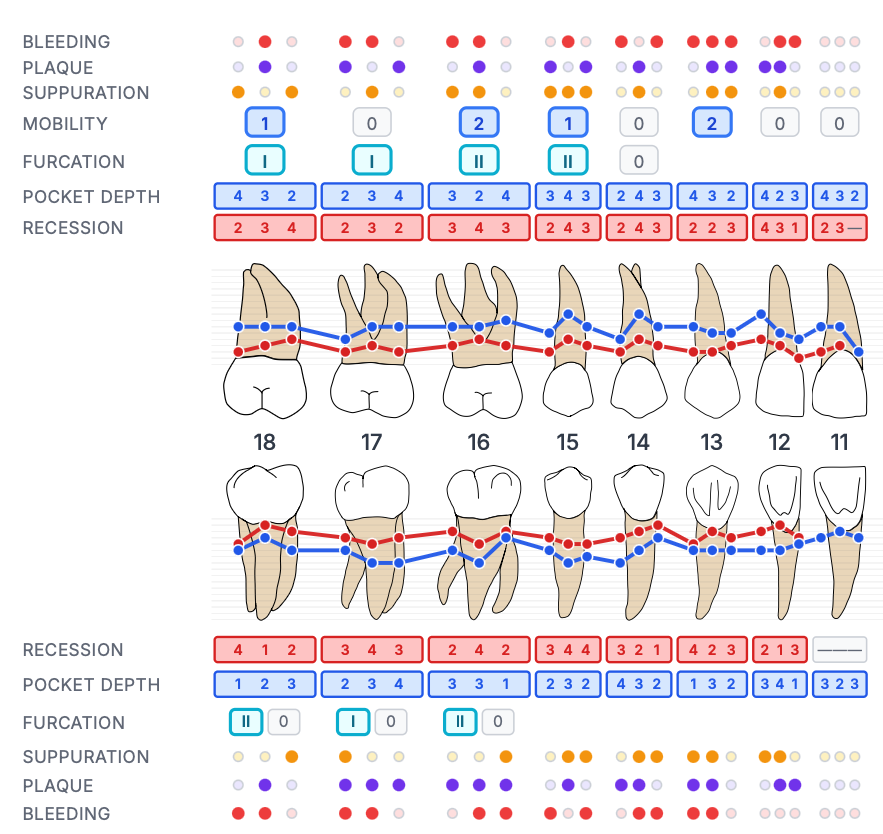 Realistic periodontal chart view for patient education