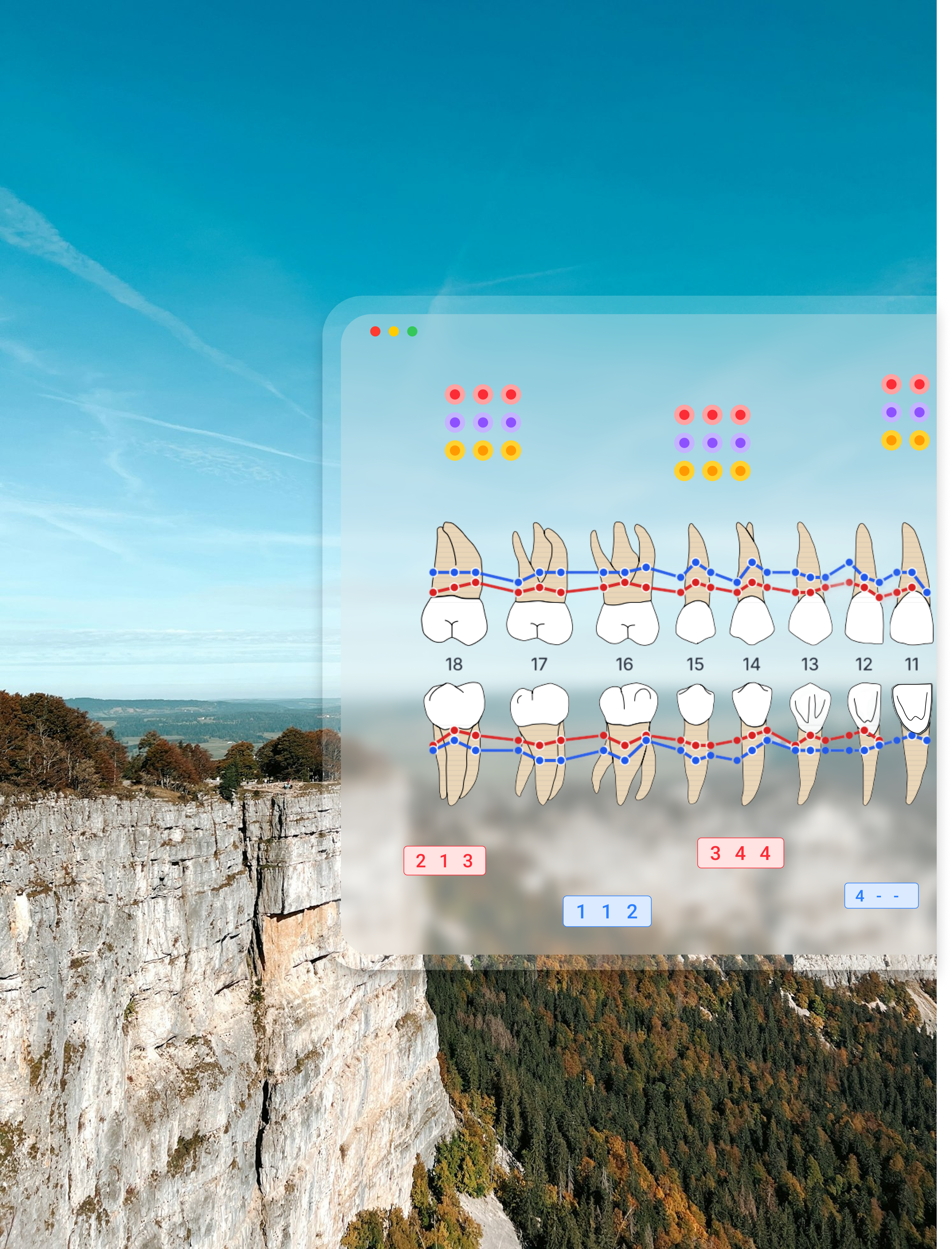 Dental professional using free periodontal chart